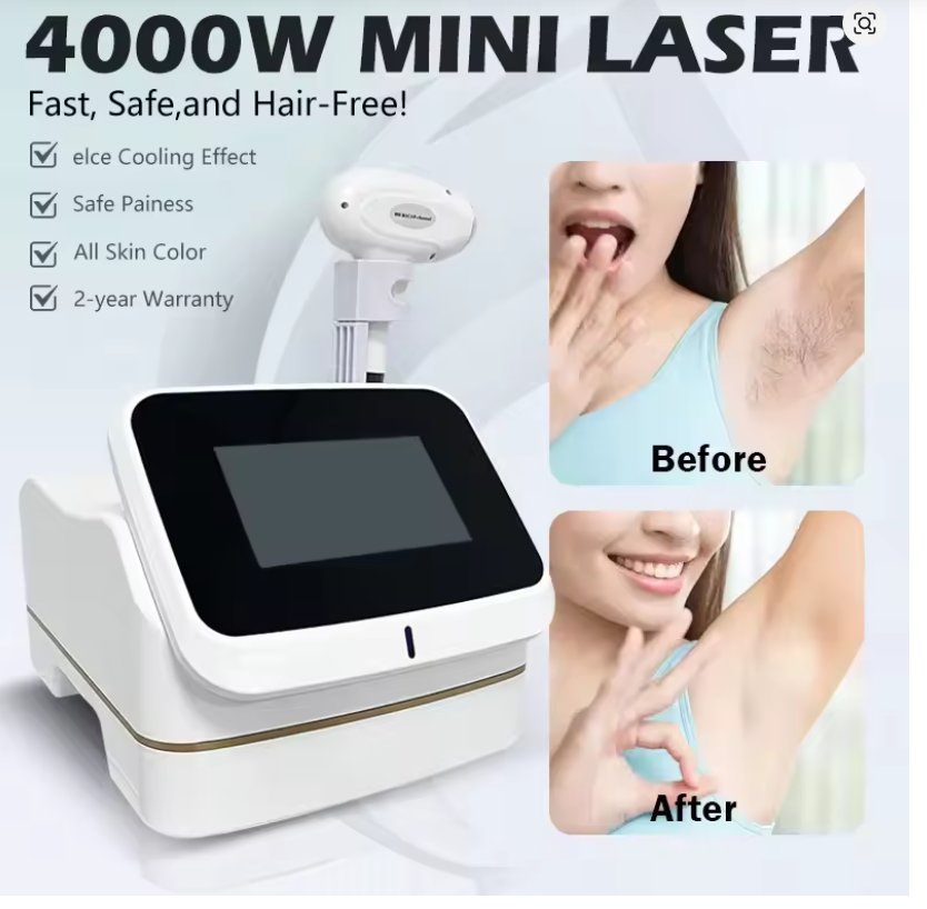 3 Wavelength 5000W 808nm Lase  - Industrial Laser Hair Removal Machine review and price